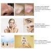 Ультразвуковая чистка | Косметологический аппарат CPY01