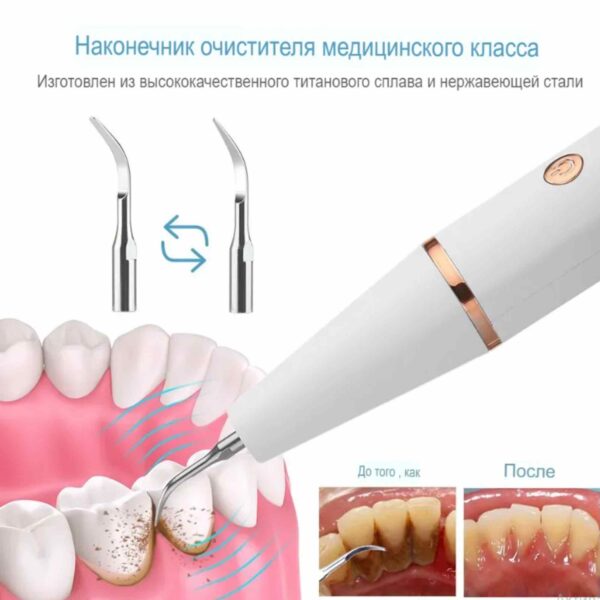 Электрическая зубная щетка ультразвуковая | Скалер для удаления зубного камня | Отбеливание зубов